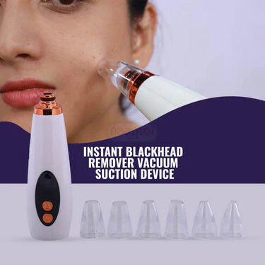 Instant Blackhead Remover Vacuum Suction Device (BHR)