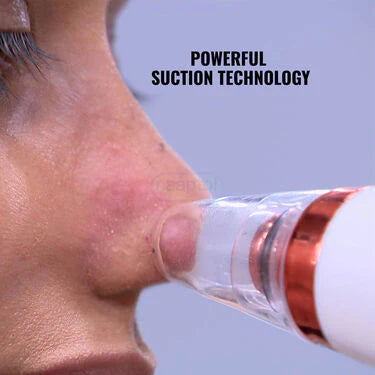 Instant Blackhead Remover Vacuum Suction Device (BHR)